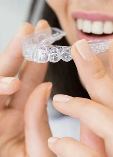dent-clear-aligner
